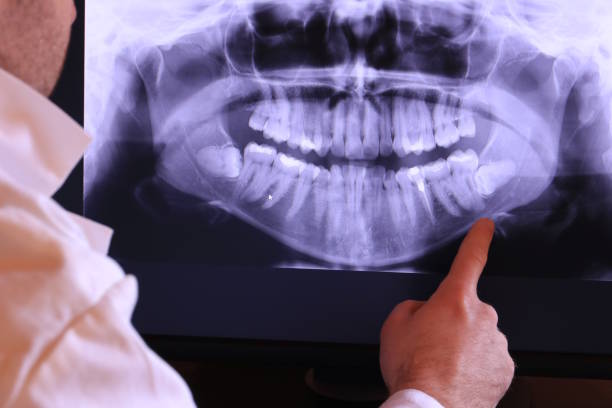 Best Emergency Root Canal Treatment in Notasulga, AL